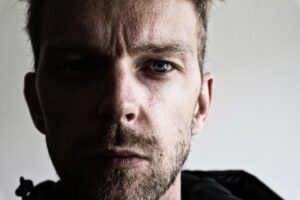 ワキガ対策に最適なクリームはどれがいい？